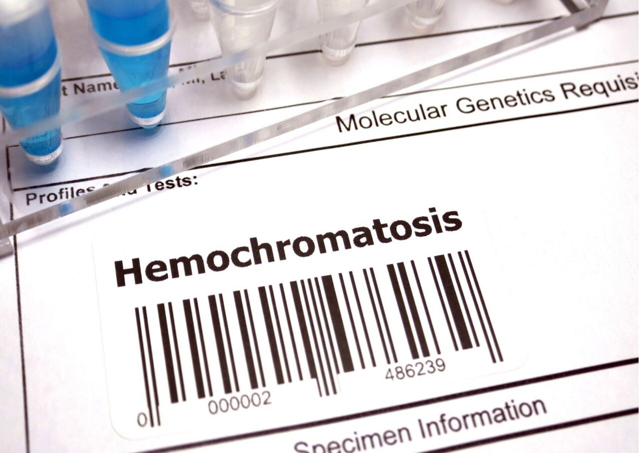 Hemochromatose